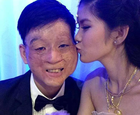 Cộng đồng mạng ngưỡng mộ cặp vợ chồng "đũa lệch"